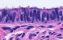 Micrograph of ciliated columnar epithelium of the fallopian tube Histology of ciliated columnar epithelium of the fallopian tube.jpg