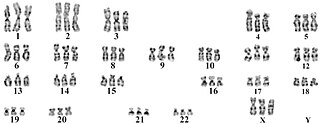 <span class="mw-page-title-main">Triploid syndrome</span> Chromosomal disorder in which there are three copies of every chromosome