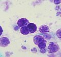 Mast cell tumor cytology