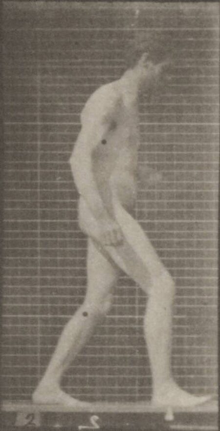 Fail:Nude man with lateral sclerosis walking (rbm-QP301M8-1887-548a~2).jpg