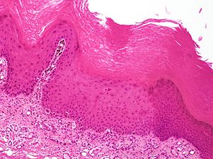 SkinTumors-P6120247.JPG