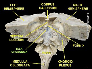 <span class="mw-page-title-main">Choroid plexus</span> Structure in the ventricles of the brain