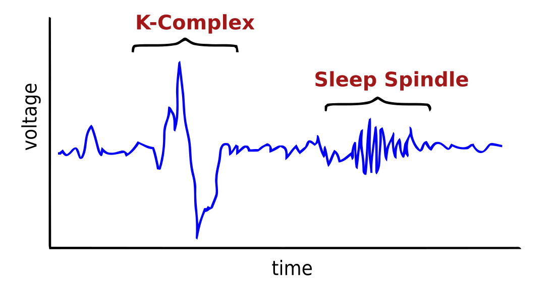 K-complex