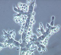 Conidiophores of Trichoderma fertile with vase-shaped phialides and newly formed conidia on their ends (bright points) Trichoderma fertile.jpg