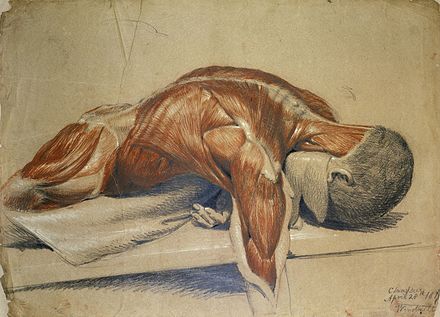 A dissected body, lying prone on a table, by Charles Landseer