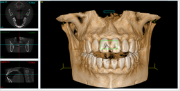 CBCT image 02.png