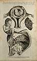 Foetus, uterus and placenta; three figures demonstrating the Wellcome V0008000.jpg