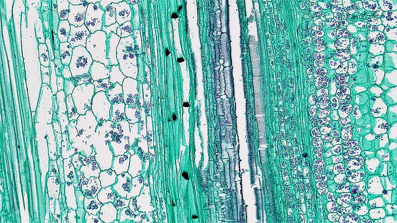 File:Herbaceous Dicot Stem Tangential Section Bicollateral Vascular Bundle in Cucurbita (35555419016).jpg