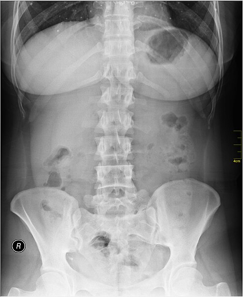 File:Medical X-Ray imaging LZT05 nevit.jpg