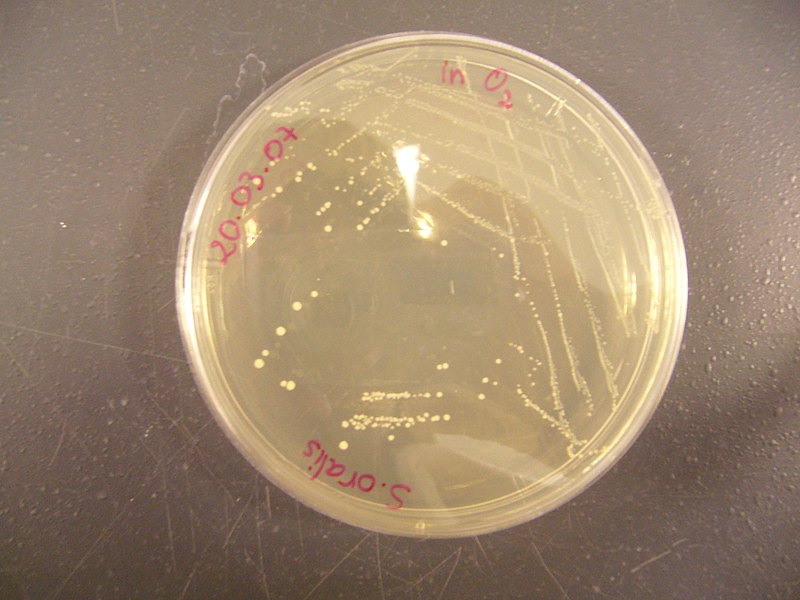 صورة:Streptococcus oralis on Wilkins-Chalgren Agar.JPG