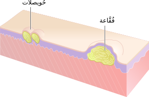 Vesicles and Bulla-ar.svg