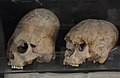 Deformed skulls, Afrasiab, Samarkand, Sogdia, 600–800 AD.