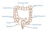 Thumbnail for Neurogenic bowel dysfunction