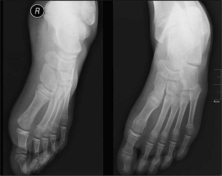 File:Medical X-Ray imaging BRT03 nevit.jpg