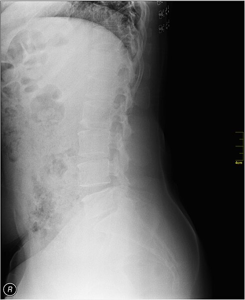 File:Medical X-Ray imaging QFF06 nevit.jpg