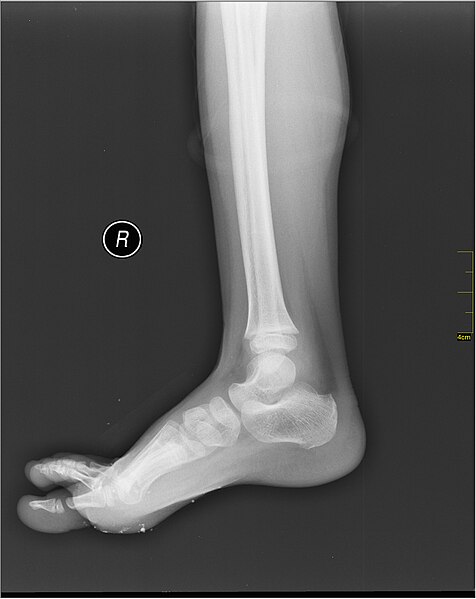 File:Medical X-Ray imaging VMX07 nevit.jpg