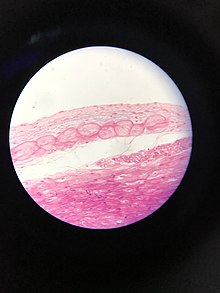 Purkinje fibers 2.jpg