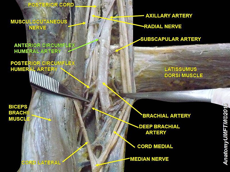 File:Slide3SSS.JPG