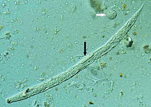Första larven av dvärgtrådmask (vit pil: amoeba av arten Entamoeba coli)