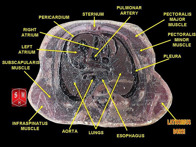 File:Thorax section 10.jpg