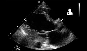 UOTW 48 - Ultrasound of the Week 5.jpg