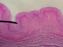 Pared vaginal humana. Imagen digital a través de un microscopio.