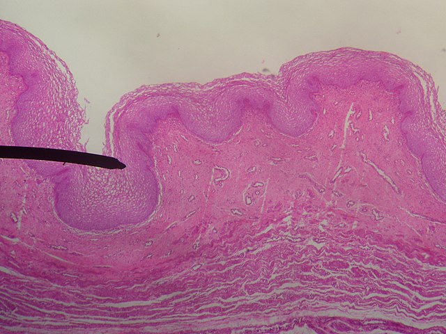Micrograph of vaginal wall