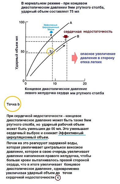 File:Эффективный циркуляционный объем31.jpg