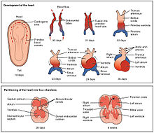 Beginning of the interventricular septum shown at 28 days 2037 Embryonic Development of Heart.jpg