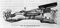 Thumbnail for Sphygmograph