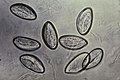 microscopic image of eggs