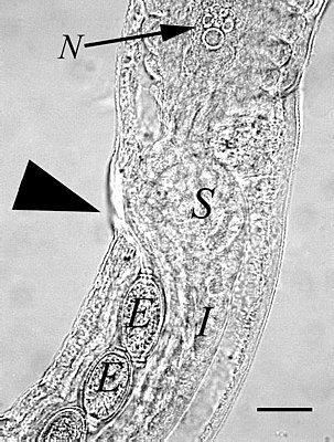 Een stichocyt bij het achterste uiteinde van de farynx in een vrouwelijke Capillaria aerophila. N: kern van de meest naar achteren gelegen stichocyt. De driehoek geeft de vulva aan, E de eitejs, I geeft het spijsverteringskanaal aan, S een uitscheidingscel. maatstreep = 50 µm