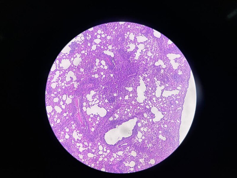 File:Histologi paru-paru.jpg