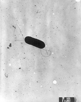 Мікрофотографія СЕМ бактерії Listeria monocytogenes.