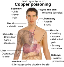 Main symptoms of copper poisoning.svg