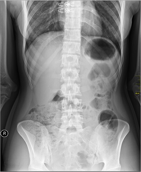 File:Medical X-Ray imaging SNW07 nevit.jpg