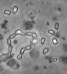 Ordospora colligata spores.JPG