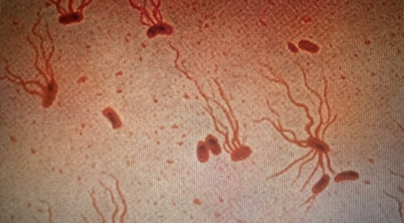 File:SalmonellaTyphiFlagellarStain.jpg