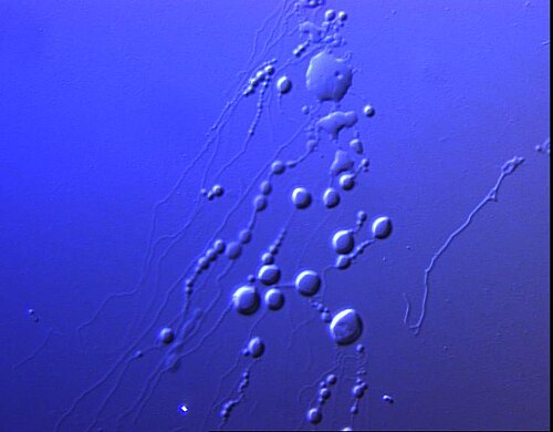 Sarfus image of lipid vesicles.