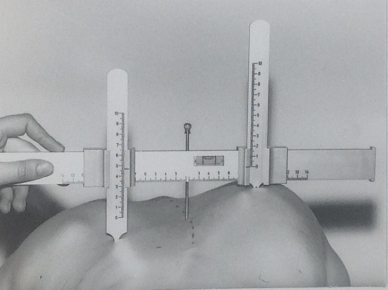 File:Skoliometer nach Götze.jpg