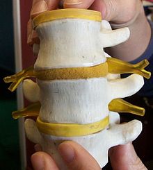 A model of segments of the human spine and spinal cord. Nerve roots can be seen extending laterally from the (not visible) spinal cord. Spinal readjustment 3.jpg
