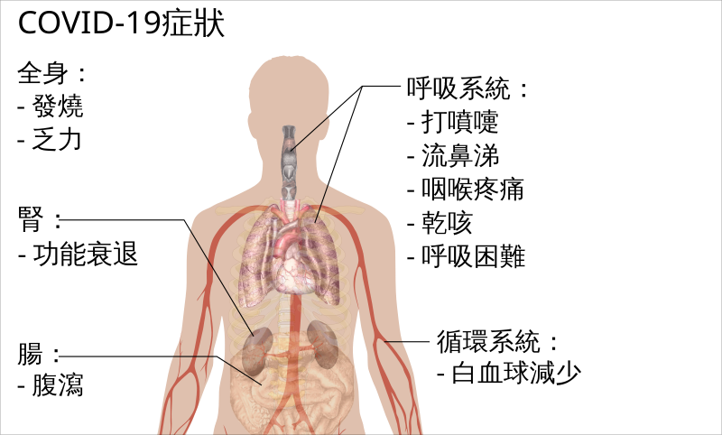 File:Symptoms of coronavirus disease 2019 in Traditional Chinese.svg