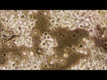 Ureaplasma és Mycoplasma fertőzések – Biztonsácampeurope.hu