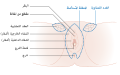 Diagram of a 3 in 1 incision vulvectomy CRUK 018-ar.svg