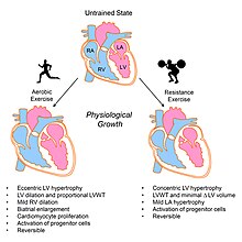 Aerobic/Endurance and Resistance/Strength exercise impact on cardiac remodeling and growth. Exercise-induced cardiac growth - Cardiac remodeling from Aerobic and Resistance exercise.jpg