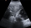 Medical Ultrasound