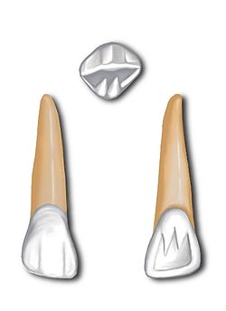 Lateral maksila incisor.jpg