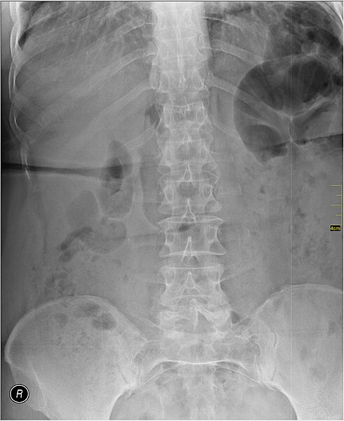 File:Medical X-Ray imaging VBJ07 nevit.jpg