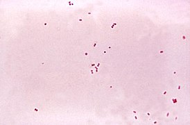 Чистая культура Neisseria meningitidis. Окраска по Граму