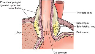 <span class="mw-page-title-main">Phrenoesophageal ligament</span>